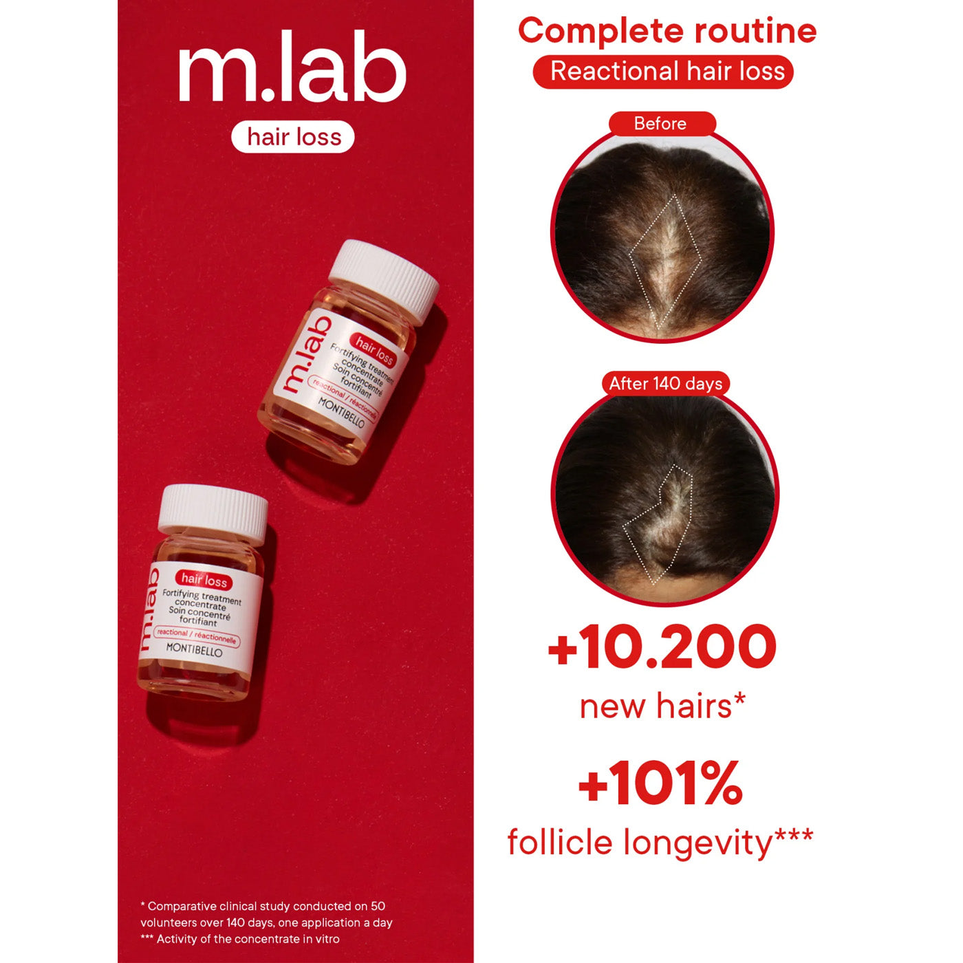 m.lab hair loss treatment bottles with before and after hair loss images on a red background