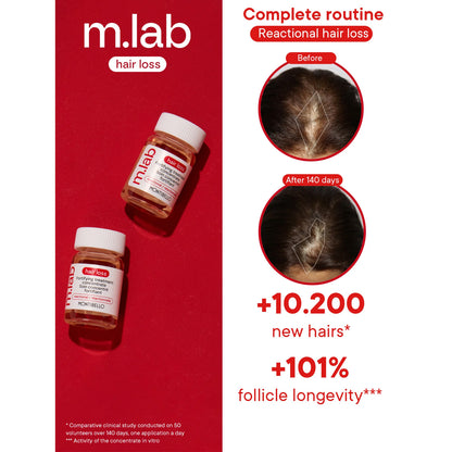 m.lab hair loss treatment bottles with before and after hair loss images on a red background